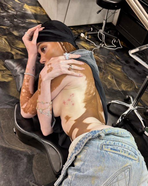 Winnie Harlow instagram post 782107