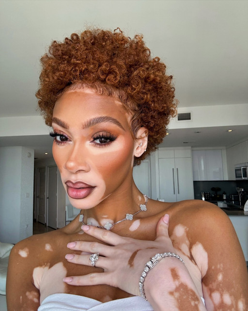 Winnie Harlow instagram post 782648