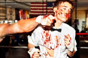 Джастина Бибера жестоко побили