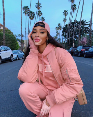 photo 21 in Winnie Harlow gallery [id1250701] 2020-03-20 00:00:00