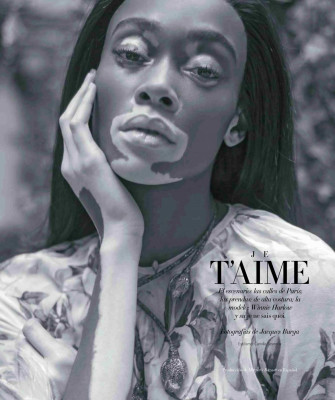 Winnie Harlow – Harpers Bazaar Mexico November 2018