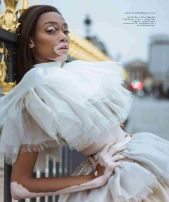 Winnie Harlow – Harpers Bazaar Mexico November 2018