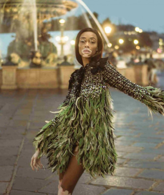 Winnie Harlow – Harpers Bazaar Mexico November 2018