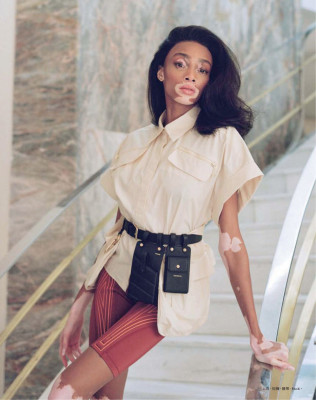 Winnie Harlow – Harper’s Bazaar Taiwan March 2019 Issue