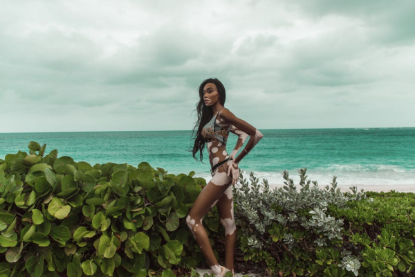 Winnie Harlow in Bikini – V Magazine Photos