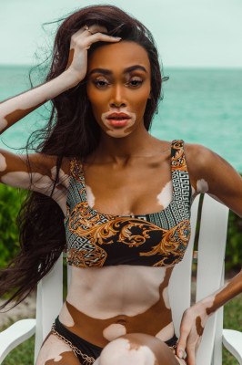 Winnie Harlow in Bikini – V Magazine Photos