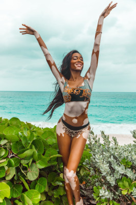 Winnie Harlow in Bikini – V Magazine Photos