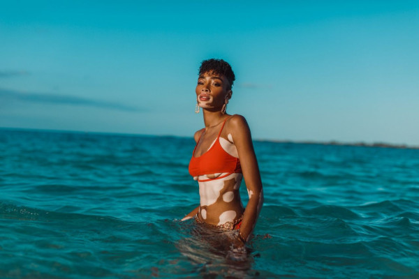 Winnie Harlow in Bikini – V Magazine Photos