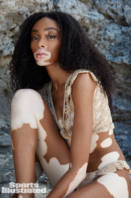 Winnie Harlow – SI Swimsuit 2019