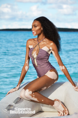 Winnie Harlow – SI Swimsuit 2019