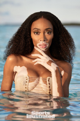 Winnie Harlow – SI Swimsuit 2019